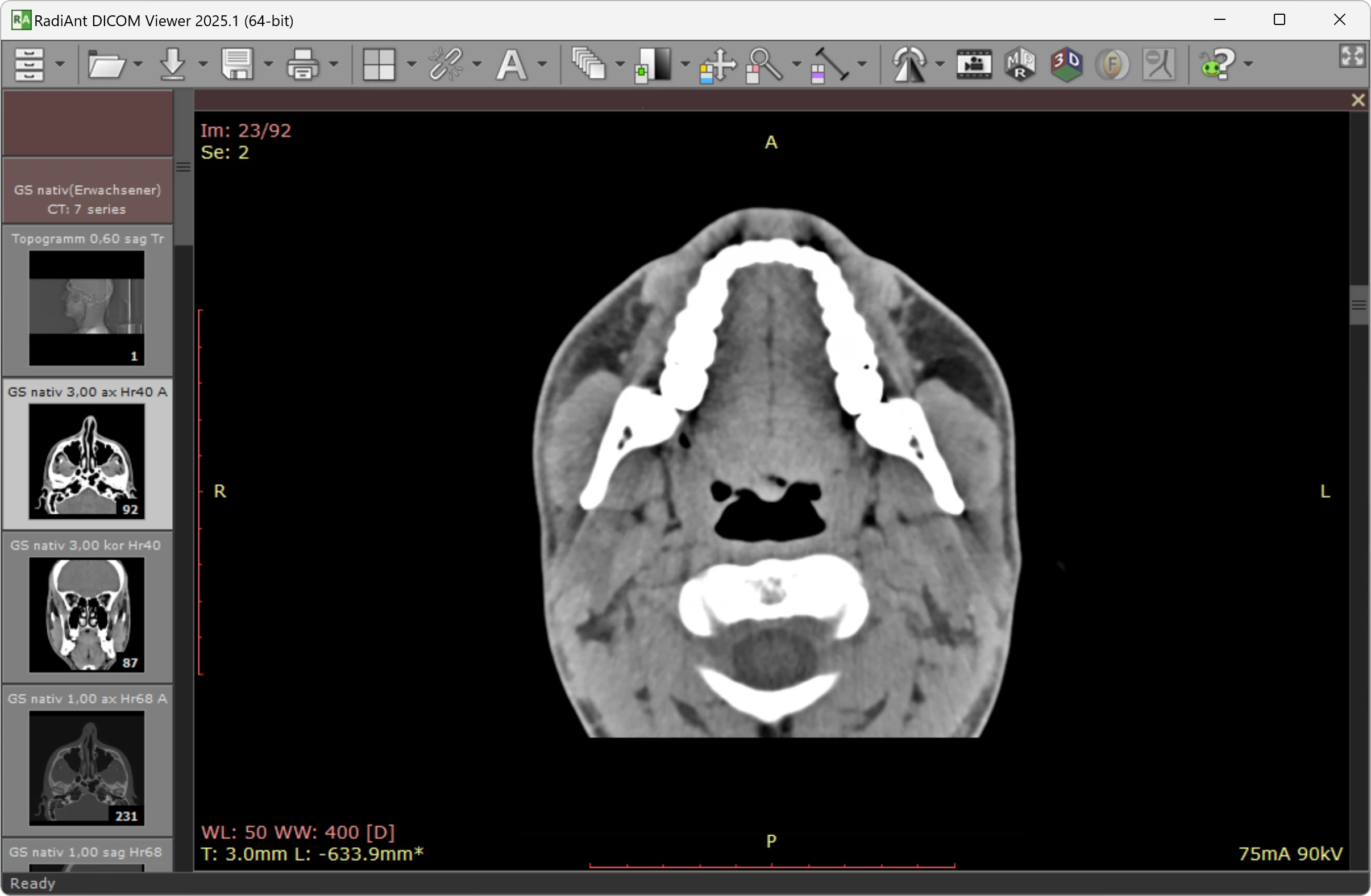 RadiAnt DICOM Viewer interface