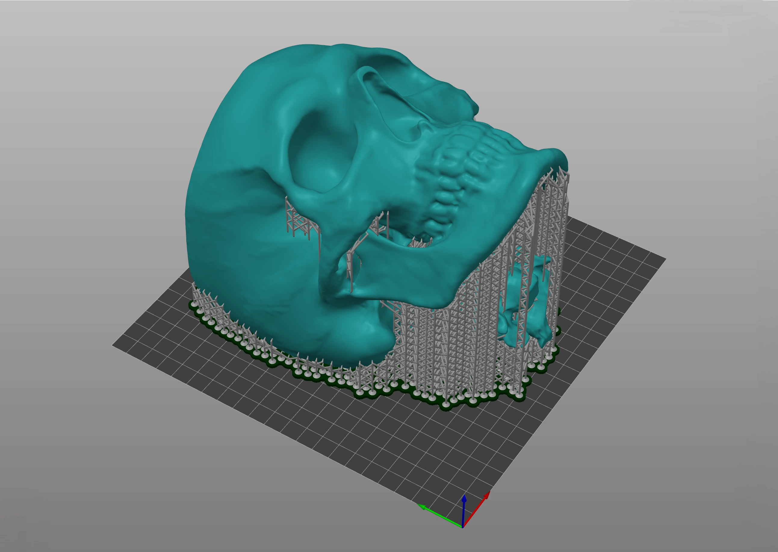 3D model with support structures in Meshmixer